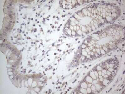 Immunohistochemistry: NT-proBNP Antibody (OTI11G4) - Azide and BSA Free [NBP2-71213]