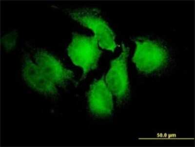Immunocytochemistry/ Immunofluorescence: NT2NL Antibody (2G12-2A5) [H00388677-M01]
