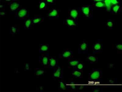 Immunocytochemistry/ Immunofluorescence: NT5C Antibody [H00030833-B01P]