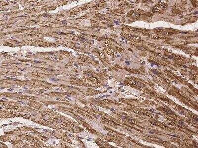 Immunohistochemistry-Paraffin: NT5C1A Antibody [NBP3-06431]