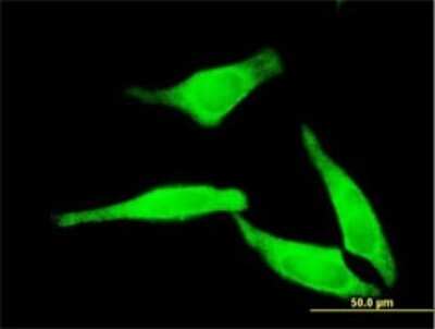 Immunocytochemistry/ Immunofluorescence: NT5C2 Antibody (3C1) [H00022978-M02]