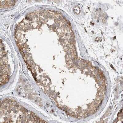 Immunohistochemistry-Paraffin: NT5C2 Antibody [NBP1-85526]