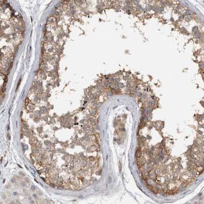Immunohistochemistry-Paraffin: NT5C2 Antibody [NBP1-85526]
