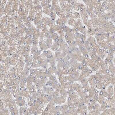 Immunohistochemistry-Paraffin: NT5C2 Antibody [NBP1-85526]