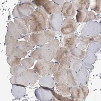 Immunohistochemistry-Paraffin: NT5C2 Antibody [NBP1-85526]