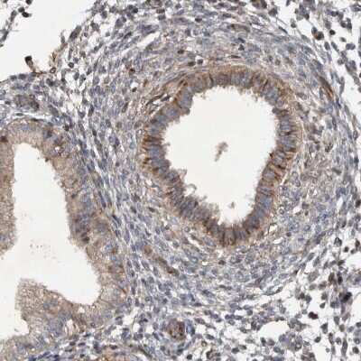 Immunohistochemistry-Paraffin: NT5C2 Antibody [NBP1-85526]