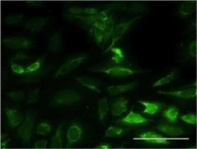 Immunocytochemistry/ Immunofluorescence: NT5M Antibody (3E2) [H00056953-M02]