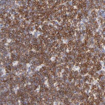 Immunohistochemistry-Paraffin: NTAL Antibody [NBP1-89661]