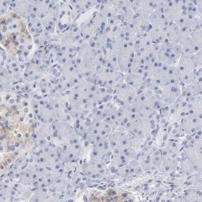 Immunohistochemistry-Paraffin: NTAL Antibody [NBP1-89661]