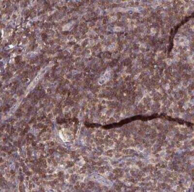 Immunohistochemistry-Paraffin: NTB-A/SLAMF6/CD352 Antibody [NBP2-49025]