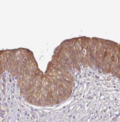 Immunohistochemistry-Paraffin: NTB-A/SLAMF6/CD352 Antibody [NBP2-49025]
