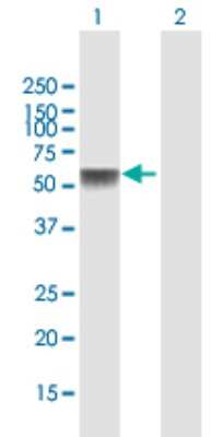 Western Blot: NTN5 Antibody [H00126147-B01P]