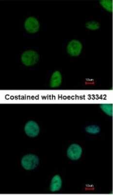 Immunocytochemistry/ Immunofluorescence: NTPCR Antibody [NBP1-31146]