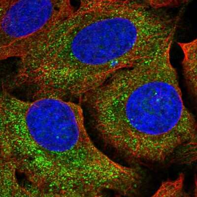 Immunocytochemistry/ Immunofluorescence: NTPCR Antibody [NBP2-38724]