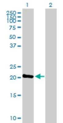 Western Blot: NTPCR Antibody [H00084284-B01P]