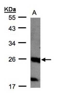 Western Blot: NTPCR Antibody [NBP1-31146]