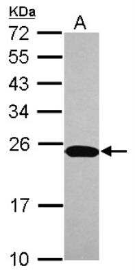 Western Blot: NTPCR Antibody [NBP2-19598]