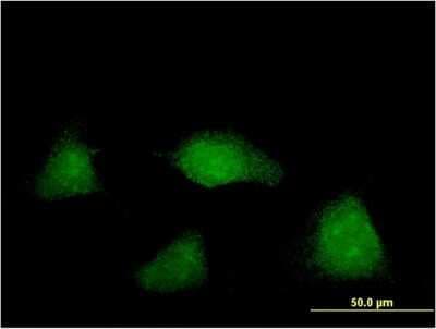 Immunocytochemistry/ Immunofluorescence: NUAK2 Antibody (2F9) [H00081788-M04]