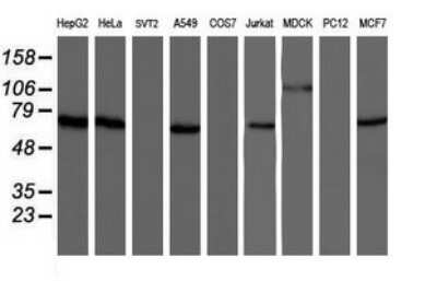 Western Blot: NUB1/NYREN18 Antibody (OTI2G1) [NBP2-46267]