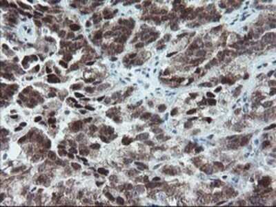 Immunohistochemistry: NUB1/NYREN18 Antibody (OTI4H2) - Azide and BSA Free [NBP2-73084]