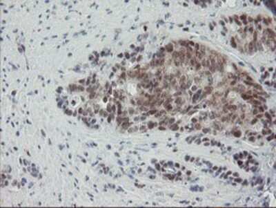 Immunohistochemistry: NUB1/NYREN18 Antibody (OTI4H2) - Azide and BSA Free [NBP2-73084]