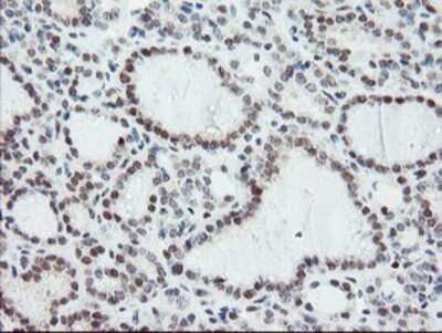 Immunohistochemistry: NUB1/NYREN18 Antibody (OTI4H2) - Azide and BSA Free [NBP2-73084]
