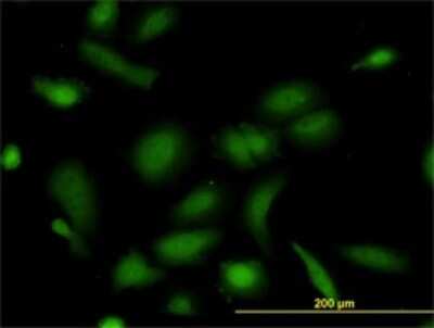 Immunocytochemistry/ Immunofluorescence: NUDC Antibody (5G12) [H00010726-M01]