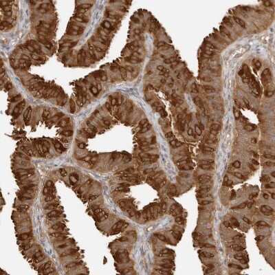 Immunohistochemistry-Paraffin: NUDC Antibody [NBP1-89517]