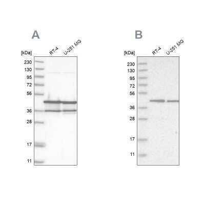 Western Blot: NUDC Antibody [NBP1-89517]