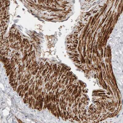 Immunohistochemistry-Paraffin: NUDCD1 Antibody [NBP1-85539]