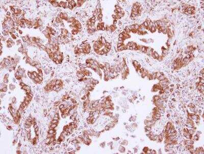 Immunohistochemistry-Paraffin: NUDCD1 Antibody [NBP2-19605]