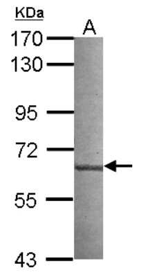 Western Blot: NUDCD1 Antibody [NBP2-19606]
