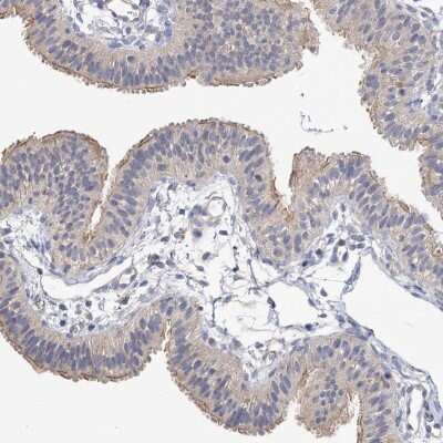 Immunohistochemistry-Paraffin: NUDCD2 Antibody [NBP1-84118]