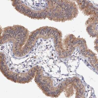 Immunohistochemistry-Paraffin: NUDCD2 Antibody [NBP2-38343]