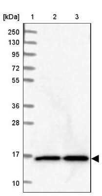 Western Blot: NUDCD2 Antibody [NBP2-38343]
