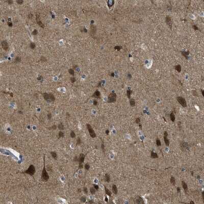 Immunohistochemistry-Paraffin: NUDCD3 Antibody [NBP1-82938]