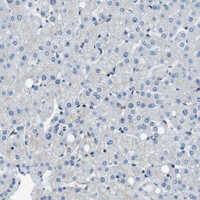 Immunohistochemistry-Paraffin: NUDCD3 Antibody [NBP1-82938]