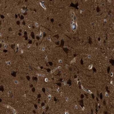 Immunohistochemistry-Paraffin: NUDCD3 Antibody [NBP1-82939]