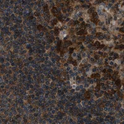 Immunohistochemistry-Paraffin: NUDCD3 Antibody [NBP1-82939]
