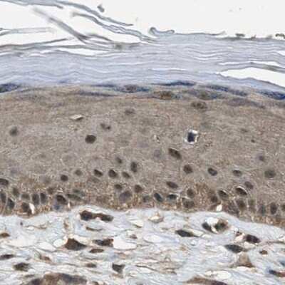 Immunohistochemistry-Paraffin: NUDCD3 Antibody [NBP1-82940]