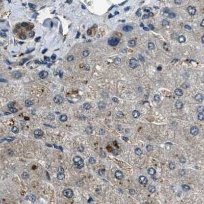 Immunohistochemistry-Paraffin: NUDCD3 Antibody [NBP1-82940]