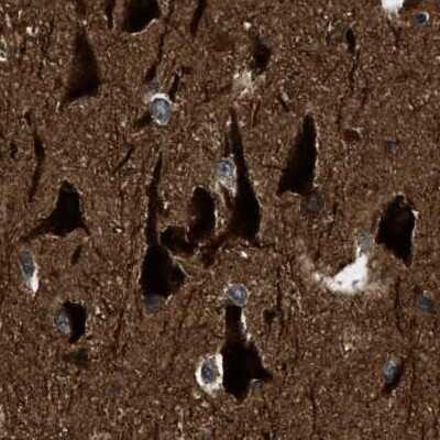 Immunohistochemistry-Paraffin: NUDCD3 Antibody [NBP1-82940]