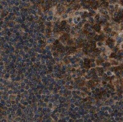 Immunohistochemistry-Paraffin: NUDCD3 Antibody [NBP1-82940]
