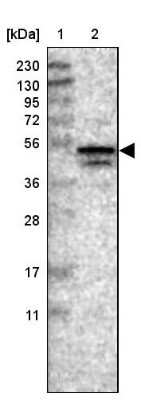 Western Blot: NUDCD3 Antibody [NBP1-82938]