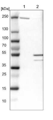 Western Blot: NUDCD3 Antibody [NBP1-82938]