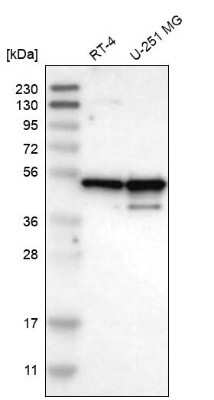 Western Blot: NUDCD3 Antibody [NBP1-82940]
