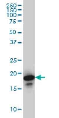 Western Blot: NUDT10 Antibody (2F8) [H00170685-M01]