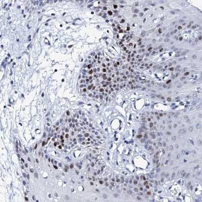 Immunohistochemistry-Paraffin: NUDT13 Antibody [NBP1-92207]