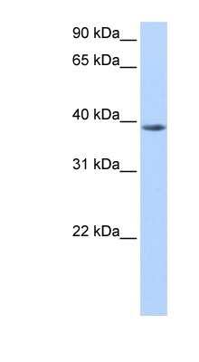 Western Blot: NUDT13 Antibody [NBP1-54929]