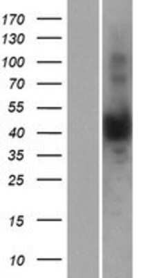 Western Blot: NUDT13 Overexpression Lysate [NBP2-07116]